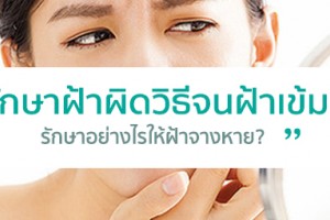 “รักษาฝ้าผิดวิธีจนฝ้าเข้ม..รักษาอย่างไรให้ฝ้าจางหาย?”