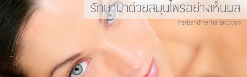 วิธีรักษาฝ้าให้หายขาด ด้วยสมุนไพรรักษาฝ้า อย่างเห็นผล